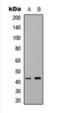 5-Hydroxytryptamine Receptor 1F antibody, orb393077, Biorbyt, Western Blot image 