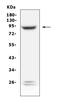 Phospholipase A2 Group VI antibody, A01648-1, Boster Biological Technology, Western Blot image 