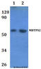 Membrane Bound Transcription Factor Peptidase, Site 2 antibody, A07369, Boster Biological Technology, Western Blot image 