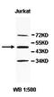 Amidohydrolase Domain Containing 1 antibody, orb77998, Biorbyt, Western Blot image 