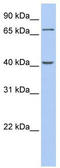 Polypeptide N-Acetylgalactosaminyltransferase 4 antibody, TA338210, Origene, Western Blot image 