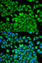 Fatty Acid Binding Protein 1 antibody, 19-579, ProSci, Immunofluorescence image 