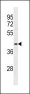 OBCAM antibody, LS-C158008, Lifespan Biosciences, Western Blot image 