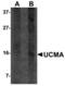 Upper Zone Of Growth Plate And Cartilage Matrix Associated antibody, TA306793, Origene, Western Blot image 
