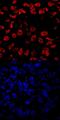 TBR2 antibody, MA5-24291, Invitrogen Antibodies, Immunocytochemistry image 