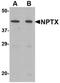 NP2 antibody, orb74979, Biorbyt, Western Blot image 