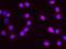 Vacuolar Protein Sorting 72 Homolog antibody, NBP1-71870, Novus Biologicals, Proximity Ligation Assay image 