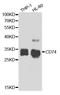 MHC class II-associated invariant chain antibody, TA332829, Origene, Western Blot image 