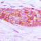 Endothelin Receptor Type A antibody, LS-C352143, Lifespan Biosciences, Immunohistochemistry paraffin image 