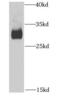 Hydroxymethylglutaryl-CoA lyase, mitochondrial antibody, FNab03928, FineTest, Western Blot image 