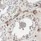 p53BP1 antibody, HPA008788, Atlas Antibodies, Immunohistochemistry paraffin image 