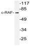 RAF proto-oncogene serine/threonine-protein kinase antibody, AP20995PU-N, Origene, Western Blot image 