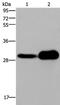 Killer Cell Lectin Like Receptor B1 antibody, PA5-50375, Invitrogen Antibodies, Western Blot image 