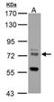 Zinc Finger DHHC-Type Containing 17 antibody, NBP2-20941, Novus Biologicals, Western Blot image 