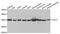 Sterol O-acyltransferase 1 antibody, TA332618, Origene, Western Blot image 