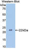 Neuraminidase antibody, LS-C292489, Lifespan Biosciences, Western Blot image 