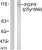EGFR antibody, TA312538, Origene, Western Blot image 