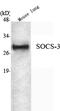 Suppressor of cytokine signaling 3 antibody, M00274-1, Boster Biological Technology, Western Blot image 