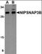 Nipsnap Homolog 3B antibody, orb89226, Biorbyt, Western Blot image 