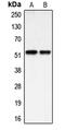 Bone morphogenetic protein 3 antibody, MBS821843, MyBioSource, Western Blot image 