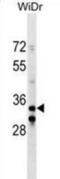 Integrin Subunit Beta 1 Binding Protein 2 antibody, abx030007, Abbexa, Western Blot image 