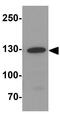 Jagged Canonical Notch Ligand 1 antibody, GTX31607, GeneTex, Western Blot image 