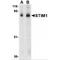 Stromal Interaction Molecule 1 antibody, TA306421, Origene, Western Blot image 