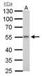 ETS Transcription Factor ERG antibody, GTX112925, GeneTex, Western Blot image 