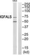 Insulin Like Growth Factor Binding Protein Acid Labile Subunit antibody, TA314057, Origene, Western Blot image 