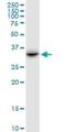 Centromere Protein V antibody, H00201161-B01P, Novus Biologicals, Western Blot image 