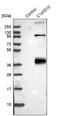 Chromosome 1 Open Reading Frame 210 antibody, PA5-53088, Invitrogen Antibodies, Western Blot image 