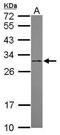 Enoyl-CoA Delta Isomerase 1 antibody, PA5-31197, Invitrogen Antibodies, Western Blot image 