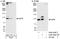 Eukaryotic Translation Initiation Factor 4 Gamma 2 antibody, A302-249A, Bethyl Labs, Western Blot image 