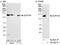SPT5 Homolog, DSIF Elongation Factor Subunit antibody, A300-869A, Bethyl Labs, Western Blot image 