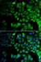 Jumonji Domain Containing 7 antibody, STJ29545, St John