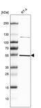 Hsc70-interacting protein antibody, HPA047116, Atlas Antibodies, Western Blot image 