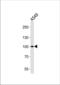 Zinc finger protein 287 antibody, TA324645, Origene, Western Blot image 