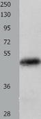 Keratin 23 antibody, TA321840, Origene, Western Blot image 