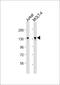 BAF Chromatin Remodeling Complex Subunit BCL11B antibody, 55-531, ProSci, Western Blot image 