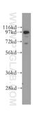 Epidermal Growth Factor Receptor Pathway Substrate 8 antibody, 12455-1-AP, Proteintech Group, Western Blot image 