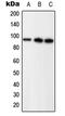 Progesterone Receptor antibody, GTX32235, GeneTex, Western Blot image 