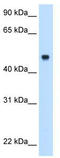 Complement component C8 beta chain antibody, TA334645, Origene, Western Blot image 