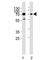 Serine/threonine-protein kinase PAK 3 antibody, F43370-0.4ML, NSJ Bioreagents, Western Blot image 