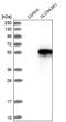 SLC9A3 Regulator 1 antibody, NBP1-84918, Novus Biologicals, Western Blot image 