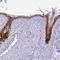 Cystatin E/M antibody, NBP2-33433, Novus Biologicals, Immunohistochemistry paraffin image 