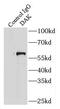 Triokinase And FMN Cyclase antibody, FNab02233, FineTest, Immunoprecipitation image 