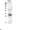C-Type Lectin Domain Family 4 Member A antibody, LS-C813298, Lifespan Biosciences, Immunohistochemistry paraffin image 
