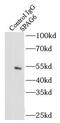 Sperm Associated Antigen 6 antibody, FNab08144, FineTest, Immunoprecipitation image 