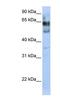 Zinc Finger Protein 564 antibody, NBP1-80144, Novus Biologicals, Western Blot image 