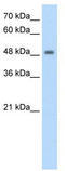 F-Box And Leucine Rich Repeat Protein 7 antibody, TA329829, Origene, Western Blot image 